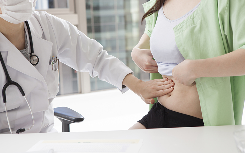 cicatriz de una abdominoplastia